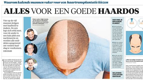 Waarom Mannen Kiezen Voor Haartransplantatie